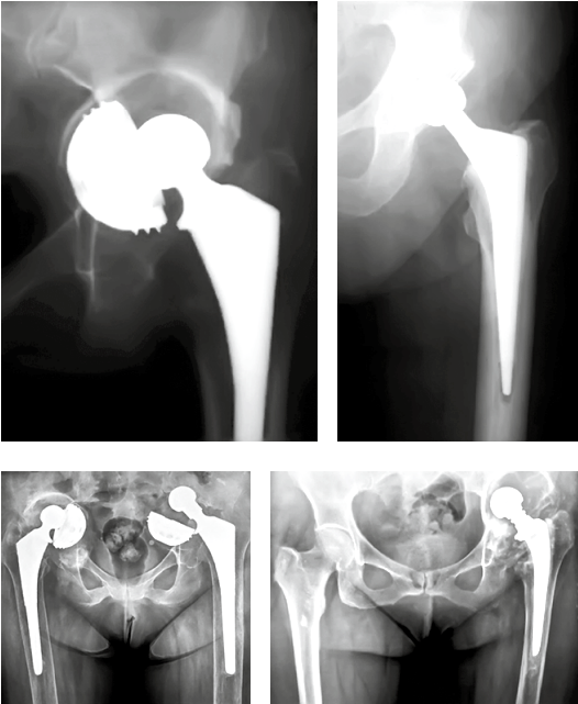 Таза есектер